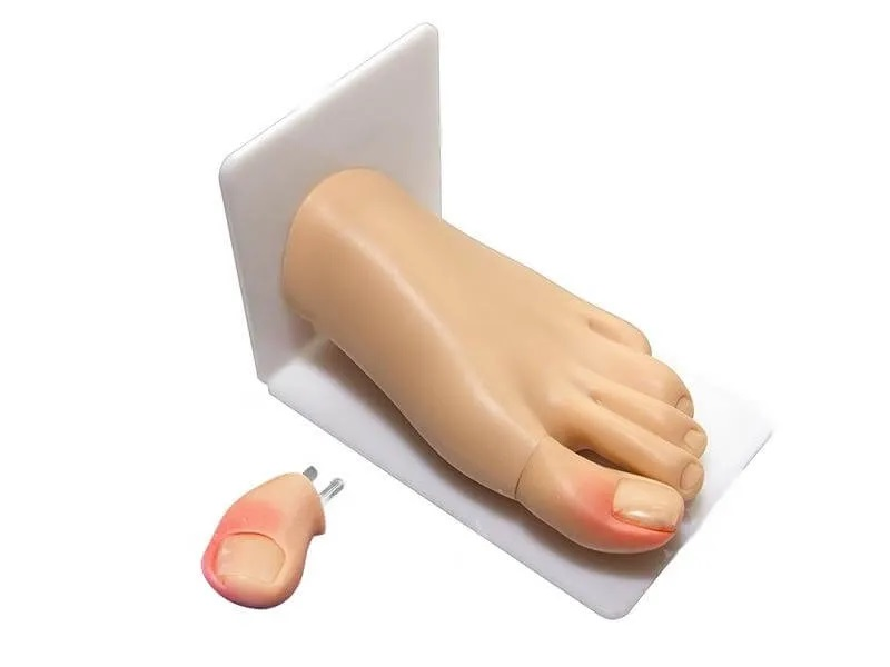 Trainer for practicing ingrown toenail removal skills Zarnitza