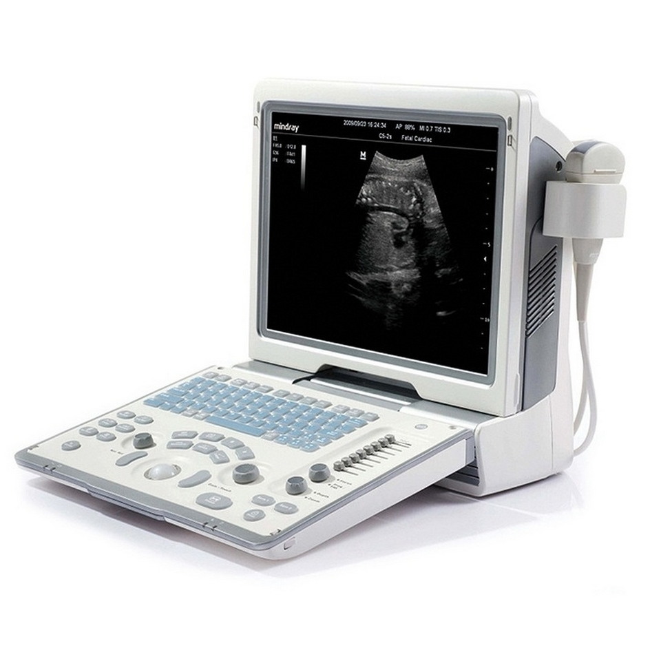Ultratovush diagnostikasi qurilmasi Mindray DP-50 (ultratovushli skaner)