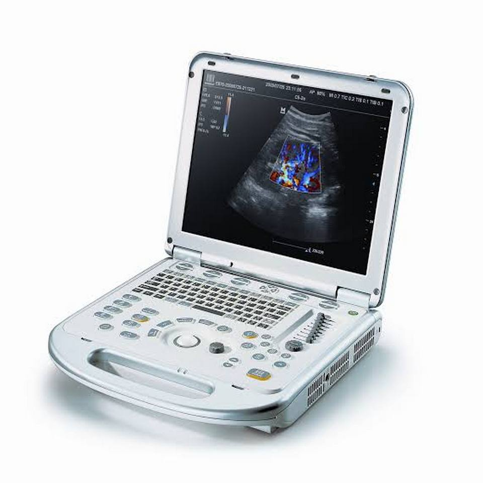 Ultratovush diagnostikasi qurilmasi Mindray M5 (ultratovushli skaner)