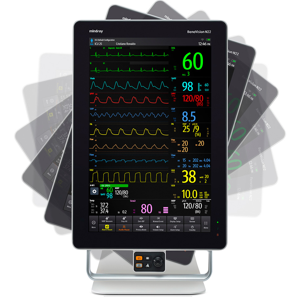 Mindray BeneVision N19 bemor monitori