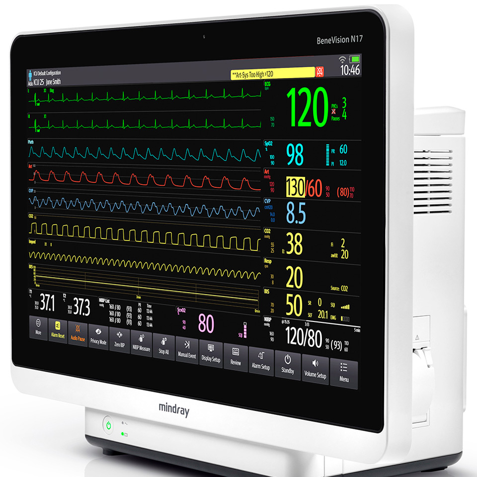 Mindray BeneVision N17 bemor monitori