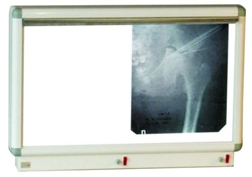 X-ray viewer NM-2 euro two-frame