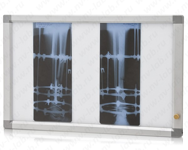 General purpose X-ray viewer "Armed" 2-frame